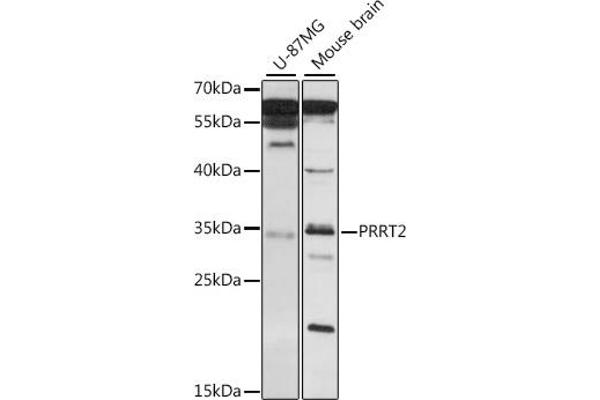 PRRT2 anticorps  (AA 20-130)