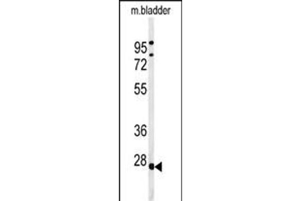 TPRG1L anticorps  (N-Term)