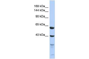 Western Blotting (WB) image for anti-Testis Expressed 11 (TEX11) (C-Term) antibody (ABIN2786547) (TEX11 anticorps  (C-Term))