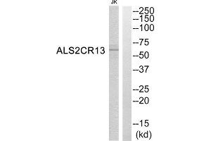 Western Blotting (WB) image for anti-Family with Sequence Similarity 117, Member B (FAM117B) (C-Term) antibody (ABIN1850760) (FAM117B anticorps  (C-Term))