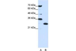 Western Blotting (WB) image for anti-Acidic (Leucine-Rich) Nuclear phosphoprotein 32 Family, Member A (ANP32A) antibody (ABIN2462045) (PHAP1 anticorps)