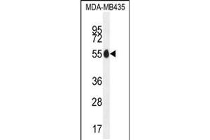 Western blot analysis in MDA-MB435 cell line lysates (35ug/lane). (PAX1 anticorps  (N-Term))