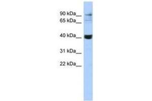 Image no. 1 for anti-Matrix Metallopeptidase 3 (Stromelysin 1, Progelatinase) (MMP3) (C-Term) antibody (ABIN6743087) (MMP3 anticorps  (C-Term))