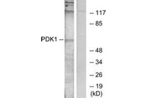 Western Blotting (WB) image for anti-3-phosphoinositide Dependent Protein Kinase-1 (PDPK1) (AA 210-259) antibody (ABIN2889054) (PDPK1 anticorps  (AA 210-259))