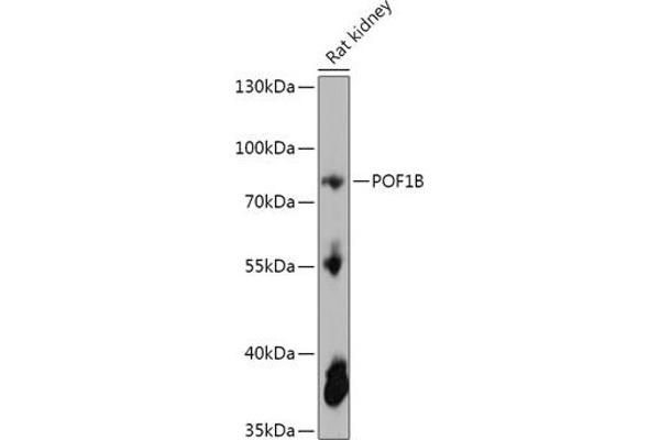 POF1B anticorps  (AA 330-560)