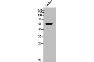 Western Blot analysis of Jurkat cells using Csk Polyclonal Antibody (CSK anticorps  (N-Term))