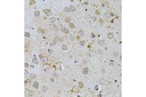 Immunohistochemistry of paraffin-embedded mouse brain using NAT8 antibody. (NAT8 anticorps)