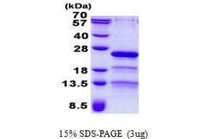 Figure annotation denotes ug of protein loaded and % gel used. (RP9 Protéine)