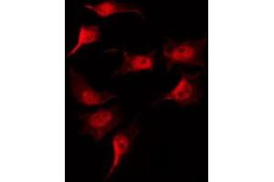 ABIN6269194 staining COLO205 by IF/ICC. (Cofilin anticorps  (N-Term))