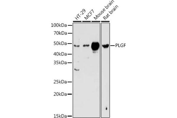 PLGF anticorps  (AA 19-170)