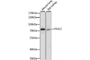 Western blot analysis of extracts of various cell lines using PRKCZ Polyclonal Antibody at dilution of 1:1000. (PKC zeta anticorps)
