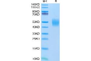 Human FGFR2 beta (IIIc) on Tris-Bis PAGE under reduced conditions. (FGFR2 beta (AA 152-377) protein (His tag))