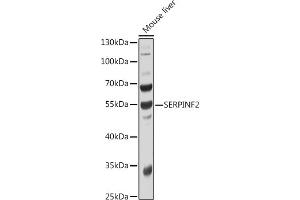 Western blot analysis of extracts of Mouse liver, using SERPINF2 antibody  at 1:1000 dilution. (alpha 2 Antiplasmin anticorps  (AA 302-491))