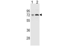 Western Blotting (WB) image for anti-Cytochrome P450, Family 2, Subfamily B, Polypeptide 6 (CYP2B6) antibody (ABIN5015645) (CYP2B6 anticorps)