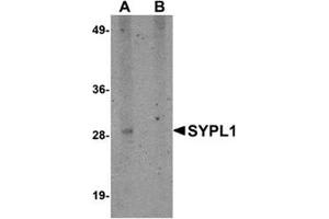 Western blot analysis of SYPL1 in human brain tissue lysate with this product at 1 μg/ml in (A) the absence and (B) the presence of blocking peptide. (SYPL1 anticorps  (N-Term))