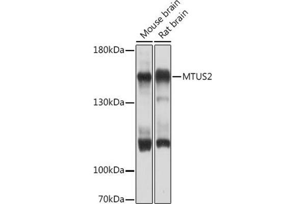 CAZIP anticorps  (AA 49-348)