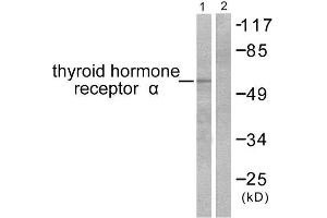 Western Blotting (WB) image for anti-Thyroid Hormone Receptor, alpha (THRA) (N-Term) antibody (ABIN1848805) (THRA anticorps  (N-Term))