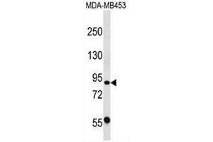 CAPN13 Antibody (C-term) western blot analysis in MDA-MB453 cell line lysates (35µg/lane). (CAPN13 anticorps  (C-Term))