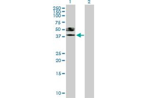 ST6GALNAC6 anticorps  (AA 1-333)