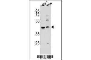 Western blot analysis in MCF-7,Hela cell line lysates (35ug/lane). (ZNF384 anticorps  (C-Term))