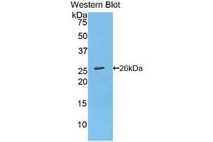 Detection of Recombinant Bcl2, Mouse using Polyclonal Antibody to B-Cell Leukemia/Lymphoma 2 (Bcl2) (Bcl-2 anticorps  (AA 2-208))