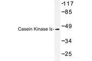 Western blot analysis of Casein Kinase Iε antibody in extracts from LOVO cells. (CK1 epsilon anticorps)