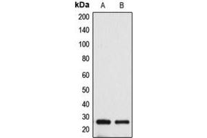 Western blot analysis of BAK expression in HeLa (A), A431 (B) whole cell lysates. (BAK1 anticorps  (N-Term))