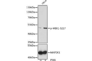 Western blot analysis of extracts of HeLa cells, using Phospho-MEK1-S217 pAb  at 1:1000 dilution or MEK1 antibody (ABIN6134386, ABIN6143481, ABIN6143482 and ABIN7101408). (MEK1 anticorps  (pSer217))