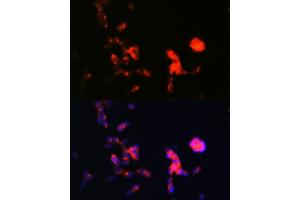 Immunofluorescence analysis of SH-SY5Y cells using DKK3 Rabbit mAb (ABIN1680063, ABIN3018243, ABIN3018244 and ABIN7101586) at dilution of 1:100 (40x lens). (DKK3 anticorps)