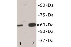 Western Blotting (WB) image for anti-Interleukin 13 Receptor, alpha 1 (IL13RA1) antibody (ABIN1854925) (IL13 Receptor alpha 1 anticorps)