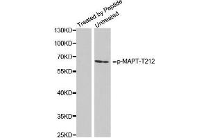 Western Blotting (WB) image for anti-Microtubule-Associated Protein tau (MAPT) (pThr212) antibody (ABIN3020349) (MAPT anticorps  (pThr212))