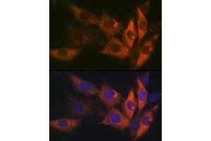 Immunofluorescence analysis of NIH-3T3 cells using AMPKβ1 Rabbit mAb (ABIN7269654) at dilution of 1:100 (40x lens). (PRKAB1 anticorps)