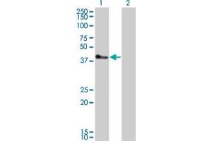 Western Blot analysis of TRIM52 expression in transfected 293T cell line by TRIM52 monoclonal antibody (M01), clone 6D5. (TRIM52 anticorps  (AA 201-297))