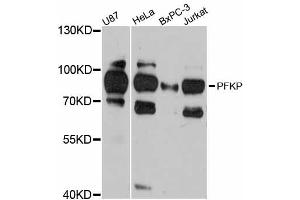 Western blot analysis of extracts of various cell lines, using PFKP antibody (ABIN5998500) at 1:3000 dilution. (PFKP anticorps)