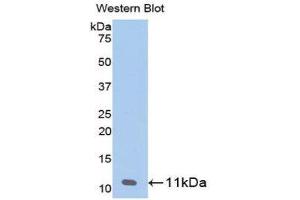 Western Blotting (WB) image for anti-Pro-Platelet Basic Protein (Chemokine (C-X-C Motif) Ligand 7) (PPBP) (AA 59-128) antibody (ABIN1858176) (CXCL7 anticorps  (AA 59-128))