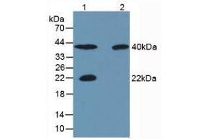 Western blot analysis of (1) Porcine Skeletal Muscle Tissue, (2) Rat Skeletal Muscle Tissue, (3) Human Liver Tissue and (4) Human Lung Tissue. (CA3 anticorps  (AA 2-260))