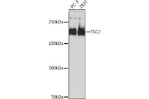 Western blot analysis of extracts of various cell lines, using TSC2 antibody (ABIN7271027) at 1:1000 dilution. (Tuberin anticorps)