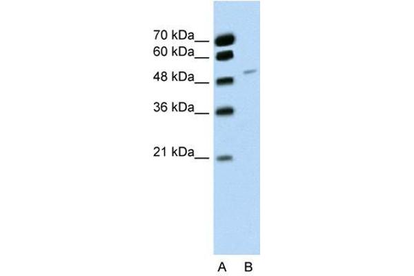 RBM22 anticorps  (C-Term)