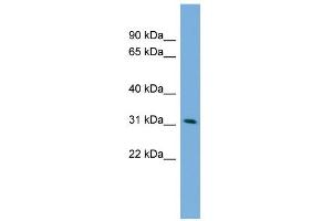 WB Suggested Anti-PPM1M Antibody Titration: 0. (PPM1M anticorps  (Middle Region))