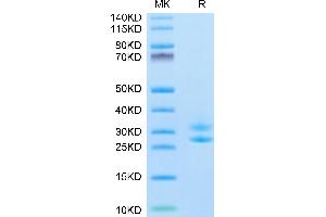Biotinylated Human IL-15RA&IL-15 (Primary Amine Labeling) on Tris-Bis PAGE under reduced condition. (IL-15/IL-15R (AA 31-108) protein (His tag,Biotin))