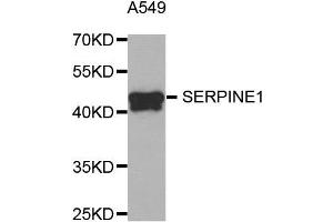 Western Blotting (WB) image for anti-Plasminogen Activator Inhibitor 1 (SERPINE1) antibody (ABIN1882338) (PAI1 anticorps)