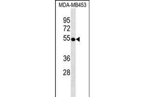 VDR Antibody ABIN1539943 western blot analysis in MDA-M cell line lysates (35 μg/lane). (Vitamin D Receptor anticorps)