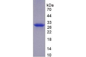 SDS-PAGE analysis of recombinant Mouse F11 Protein. (Factor XI Protéine)