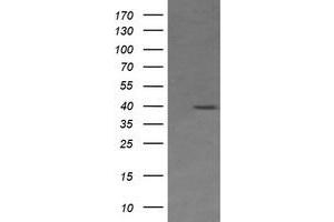 Image no. 1 for anti-Mitogen-Activated Protein Kinase Kinase 3 (MAP2K3) antibody (ABIN1499408) (MAP2K3 anticorps)
