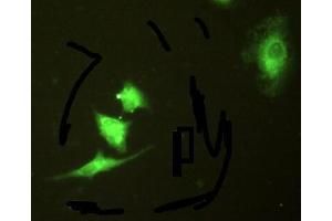 IHC-P analysis of A549 cells, with FITC staining. (Integrin beta 3 anticorps  (AA 135-377))