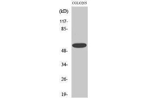 Western Blotting (WB) image for anti-Chloride Channel CLIC-Like 1 (CLCC1) (Internal Region) antibody (ABIN3183952) (CLCC1 anticorps  (Internal Region))