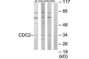 Western blot analysis of extracts from COLO205/HuvEc/Jurkat cells, using CDC2 Antibody. (CDK1 anticorps  (AA 101-150))