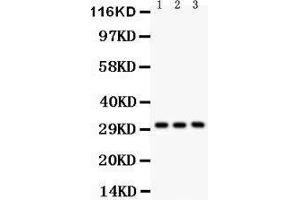 Anti-VDAC Picoband antibody, Western blotting All lanes: Anti VDAC  at 0. (VDAC1 anticorps  (Middle Region))