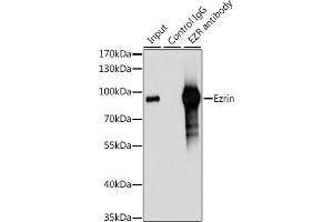 Immunoprecipitation analysis of 200 μg extracts of 293T cells, using 3 μg Ezrinin antibody (ABIN6129377, ABIN6140400, ABIN6140401 and ABIN6213959). (Ezrin anticorps  (AA 350-470))