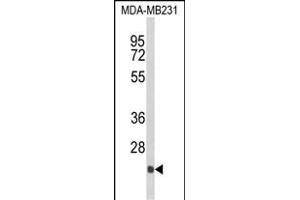 Western blot analysis of DERL2 Antibody (C-term) (ABIN652652 and ABIN2842438) in MDA-M cell line lysates (35 μg/lane). (Der1-Like Domain Family, Member 2 (DERL2) (AA 191-218), (C-Term) anticorps)